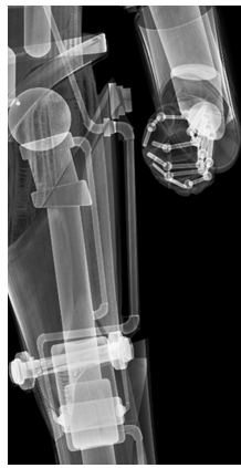 Dalek X-Ray Mockup